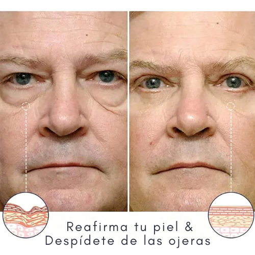 Tratamiento reparador de piel berbax