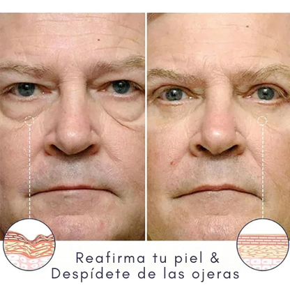 Tratamiento reparador de piel berbax